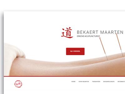 Acupunctuur Bekaert